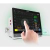Monitor functii vitale pacienti CX10 EDAN cu ecran tactil de 10,1 inch