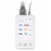 Holter de monitorizare ECG / EKG si tensiune SA-20 EDAN